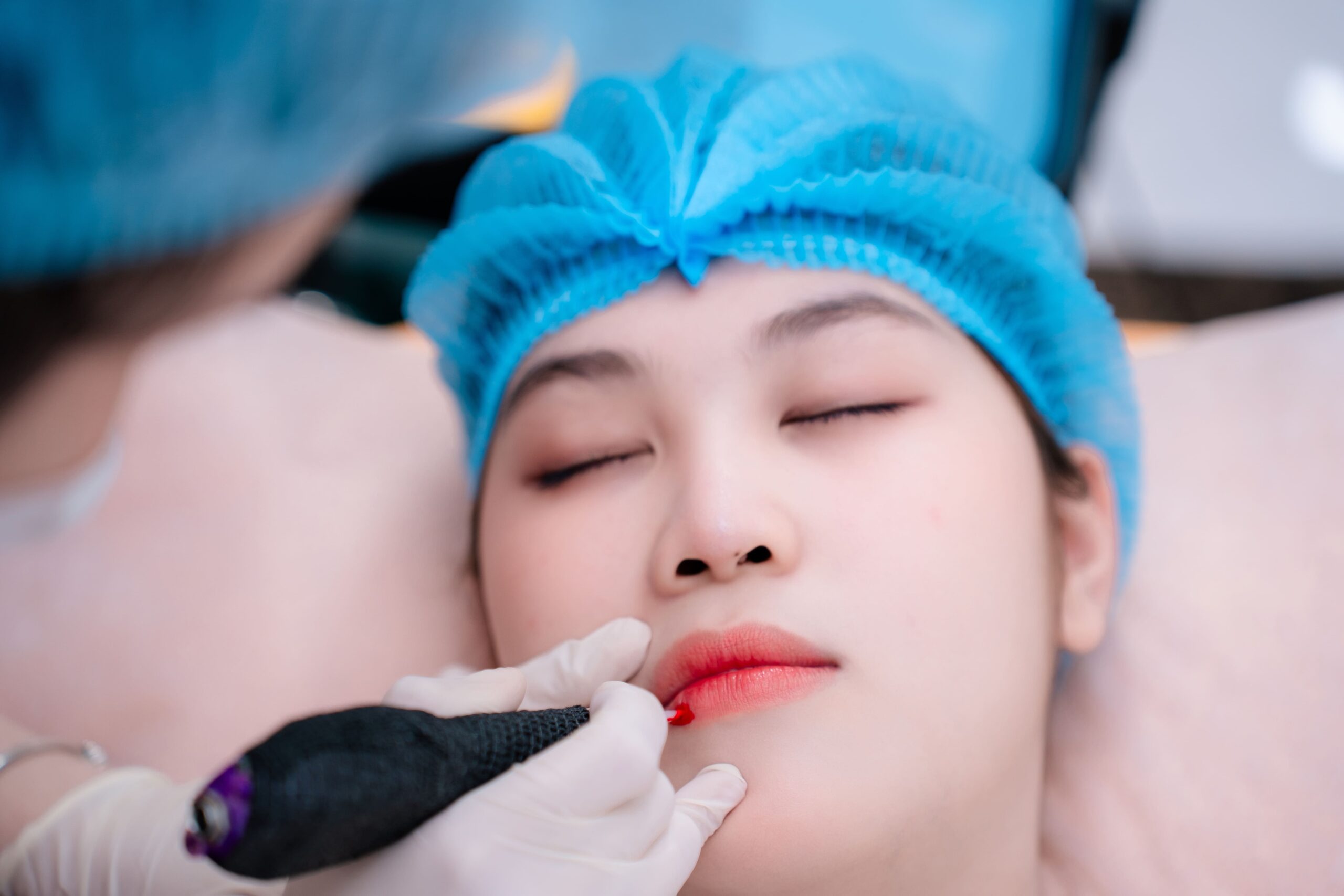 phun môi tế bào gốc