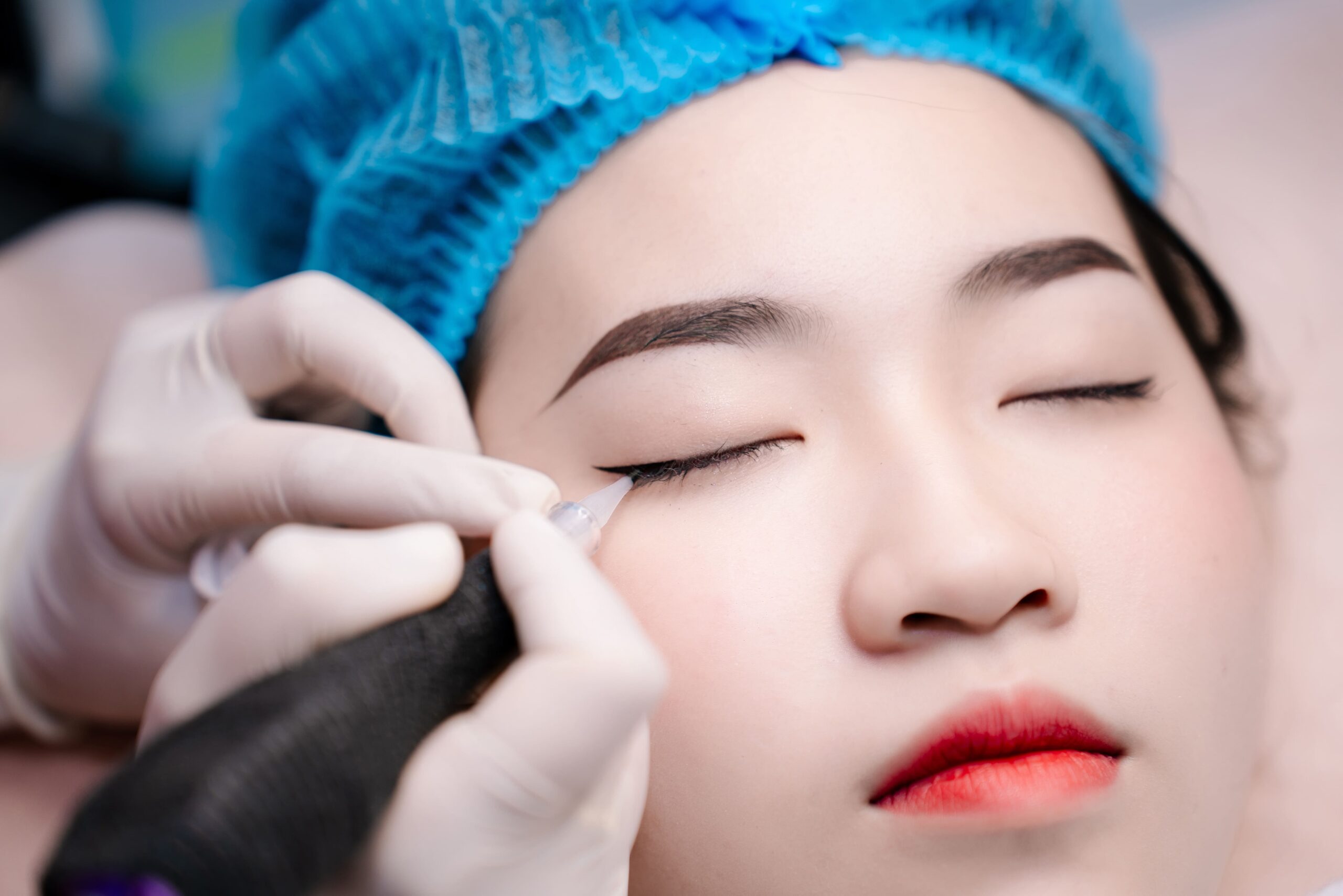 Có nên phun mí mắt trên không