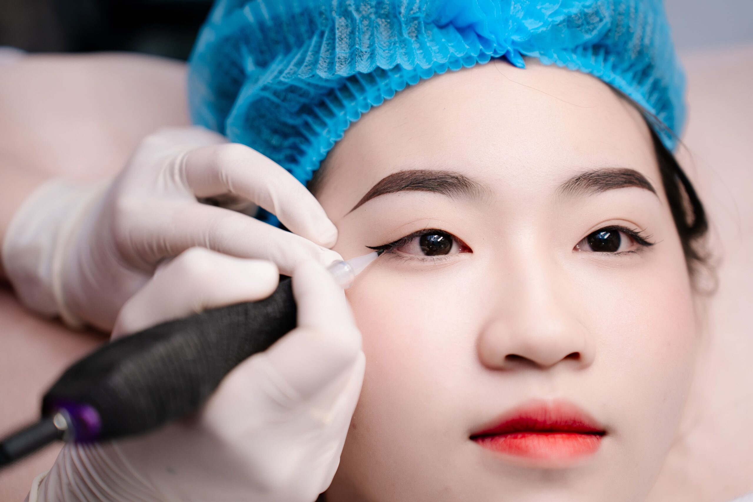 Có nên phun mí mắt trên không