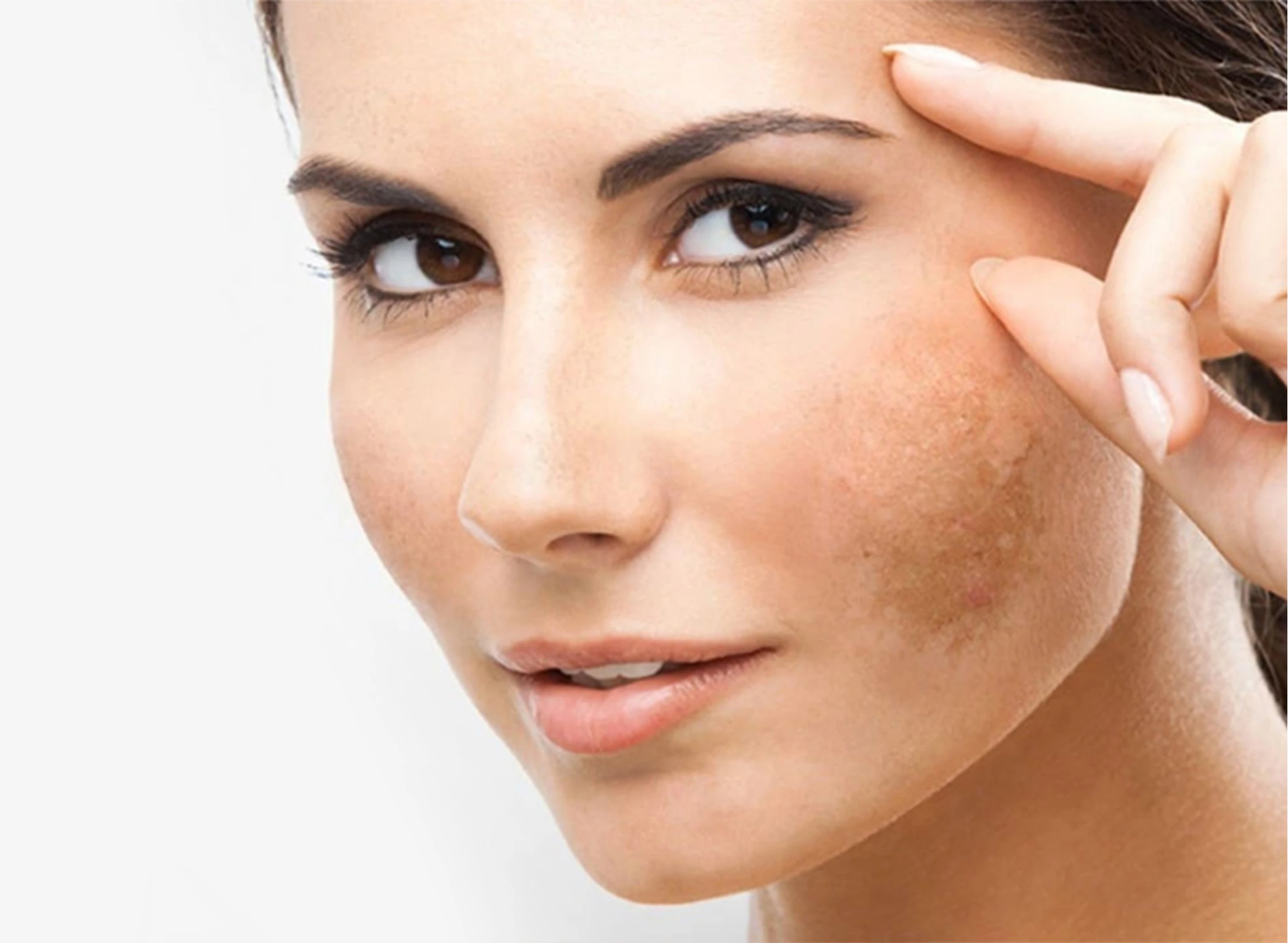 điều trị da chuyên sâu tại Cần Thơ