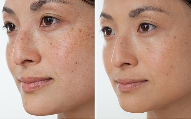 điều trị da chuyên sâu tại Cần Thơ