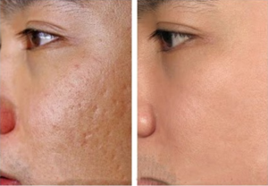 điều trị da chuyên sâu tại Cần Thơ