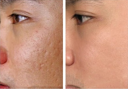 điều trị da chuyên sâu tại Cần Thơ