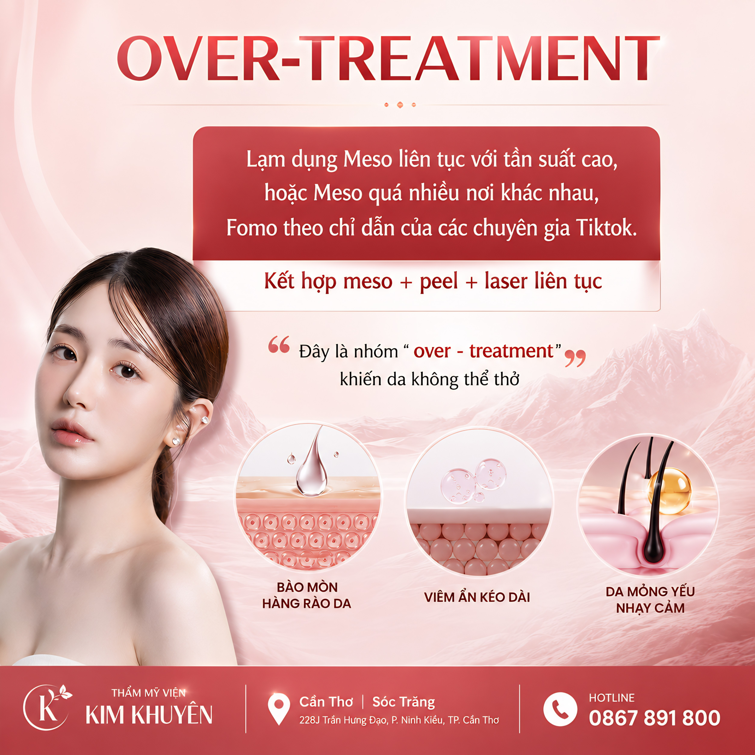 dich vu uu dai kim khuyen